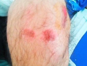 02ago13-filho-gai-agredido.2