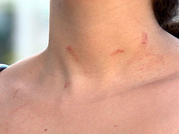 28abr14-escriva-agredida-2