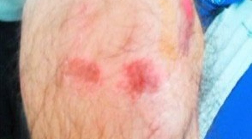 02ago13-filho-gai-agredido.2