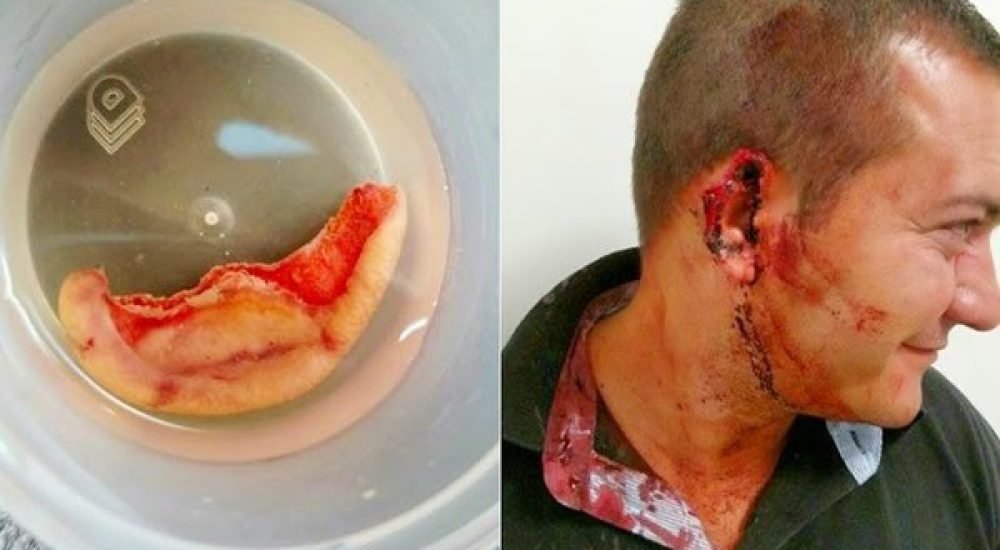 13abr15-sp-orelha-arrancada-3