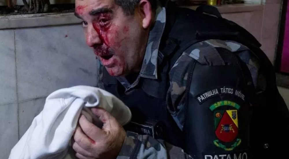 17out24-DP-policial-ferido-1