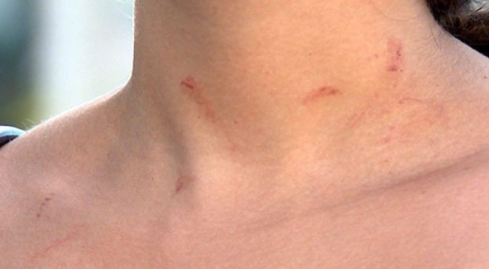 28abr14-escriva-agredida-2