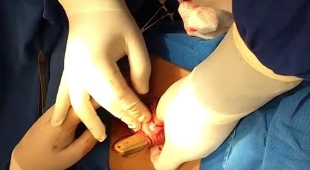 7843188bb9673ebb741666d38b521d52