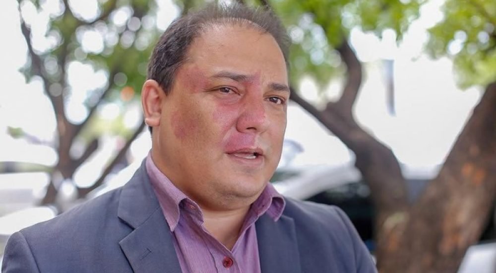 f032cc7f6f51fcf5589c6f5f5670c9d0